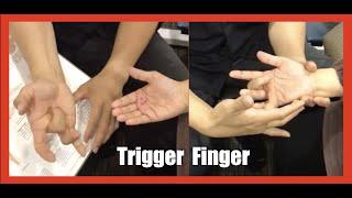 Trigger Finger - Some tips and advice from Master Chris Leong on DIY at home method.