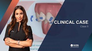 Clinical Case | Class II - Dr. Lucia Giuliano