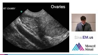 10 Ectopic Pregnancy