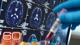 Alzheimer's and Dementia | 60 Minutes Full Episodes