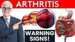 The 3 Types of Arthritis - Dr. Gundry Tells You The Warning Signs!