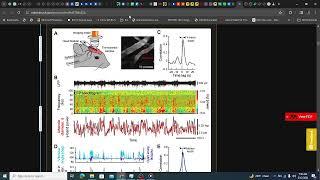 Ultra-slow oscillations in fMRI and resting-state connectivity: Neuronal and vascular contributions