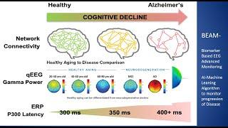 Early Detection of Alzheimer's - Can AI Machine Learning Help? (Biomarker – Based EEG)