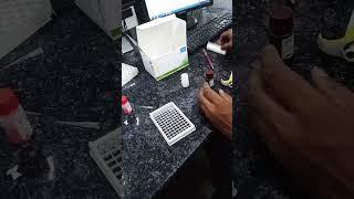 TSH test #viral #lab