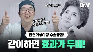 [EN/JP / CN] 안면거상 과 이 수술을 같이하면 효과가 두 배!!
