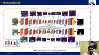 72-SDDSC-Net:  Conv NN with Undecimated Discrete Wavelet Fusion for Change Detection