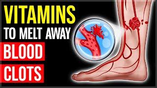 MELT Away Blood Clots With These 10 POWERFUL Vitamins & Foods