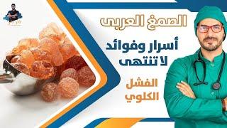 الصمغ العربى/ لماذا لايجب الاستغناء عنه / الفشل الكلوى و فوائد لاتنتهى