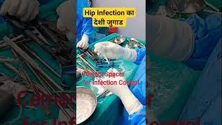 Hip Infection Control Cement Spacer देशी जुगाड 