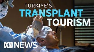 Türkiye’s thriving hair transplant industry | ABC News