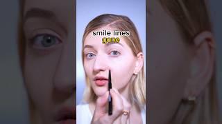 smile lines gone #smilelines #faceyoga #facemassage #faceexercises #facefitness #facialyoga