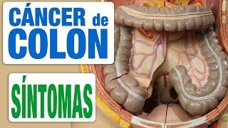 Cáncer de Colon - Síntomas