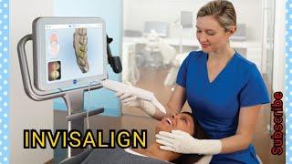 How Invisalign Braces Work?