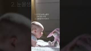 아기 눈과 눈곱 관리 / 아기 시력, 결막염, 사시 / 아기 눈에 안약 넣는 법