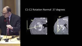 Dr. Myles Koby, MD: Imaging Cervical and Cranio-Cervical Instability in Connective Tissue Disorders