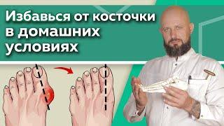 Как избавиться от шишки на ноге? / Эффективные упражнения для восстановления суставов