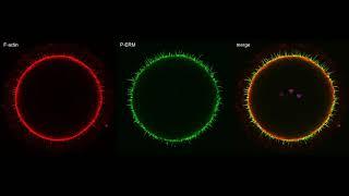 Elongated microvilli are enriched in phosphorylated ezrin/radixin/moesin.