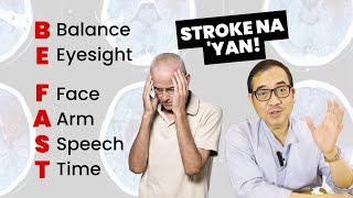 Alamin ang SIGNS NG STROKE! BE FAST | DR TONY LEACHON