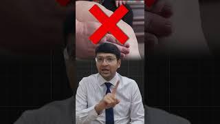 Kya Varicose Vein Me Pair Kaatna Padta Hai? #varicoseveins #legpain