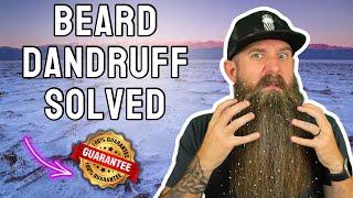 Quick Guide to Curing Beard Dandruff! 100% success rate