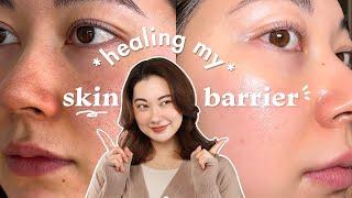 How I heal my Skin Barrier in 1 WEEK~! my skincare routine for irritated skin ‍