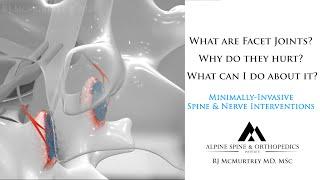 What are Facet Joints, Why do they Hurt, and How should they be Treated? An Overview of Spine Facets