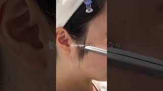 うなじを整える訳とは️#美容 #うなじ脱毛 #dermaplaning