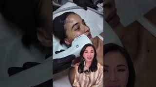 Anne Curtis facelift by Dra. Vicki Belo