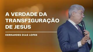 POR QUE A TRANSFIGURAÇÃO DE JESUS TRANSFORMA NOSSA FÉ? - HERNANDES DIAS LOPES