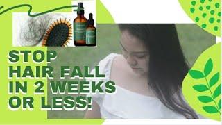 Effective Solution to Hair Fall ft. SUDTANA | Treatment for Hair Loss, Dandruff, & Frizzy Hair