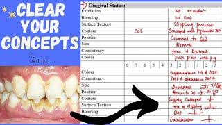 Examination Of The Gingival Status ‖ Health VS Gingival Disease ‖ Gingival Considerations ‖ PerioHub