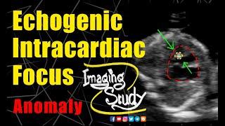 Fetal Echogenic Intracardiac Focus || Ultrasound || Anomaly || Case 261