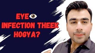 Eye infection Theek Huwa ya nai | Eye infection | Malik Ahmer Vlogs #eyeinfection