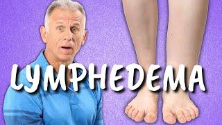 10 Exercises for Leg Lymphedema (Swelling or Edema of the Lower Extremities)