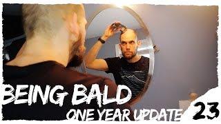 BEING BALD, ONE YEAR UPDATE | Vlog 023