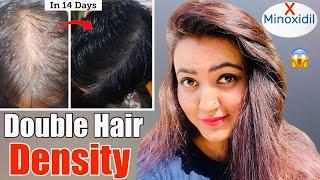 14 Days Challenge : Try This Hair Growth Remedy To Get Double Hair Density & Thick, Long Hair️