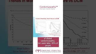 Dilated cardiomyopathy prognosis