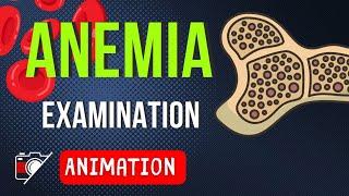 🩸WHAT IS ANEMIA ? | DEFINITIONS | INTRO | PEDIATRICS | Animation