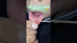 治療嘴破的神奇藥水