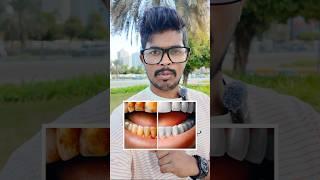 Unga Pallu Eppdi Irukku #teething #teethtechnology #technology #tamiltech #adhavanaj