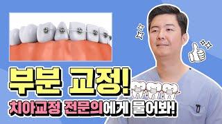 [영등포치아교정] 부분교정, 정확하게 무엇일까요?
