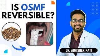 IS OSMF REVERSIBLE?