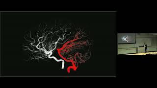 Neurointerventional Stroke Treatment & Research Frontiers