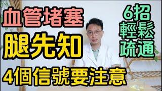 血管堵塞腿先知！儅腿部出現4個信號時，可能是血管在報警！醫生推薦6招，輕鬆疏通血管，預防血管堵塞！