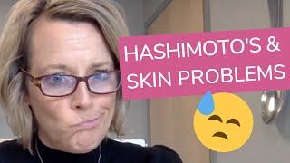 3 Common Skin Problems Associated with Hashimoto's | Sara Peternell