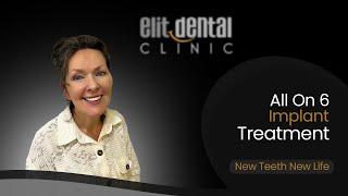 Angela's All On 6 Implant Treatment  #allon6 #dentistry #kuşadası #dentaltourism