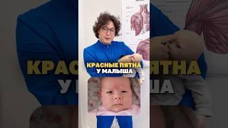 Красные пятна у малыша #материнство #родители #дети  #мама #семья #роды