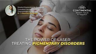 The Power of Laser: Treating Pigmentary Disorders | Continental Hospitals