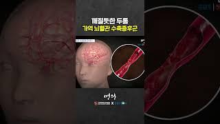 What is the cause of sudden headaches?