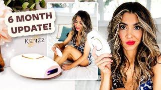 6 Month Update! Does Kenzzi IPL Really Work? | DIY with Orly Shani